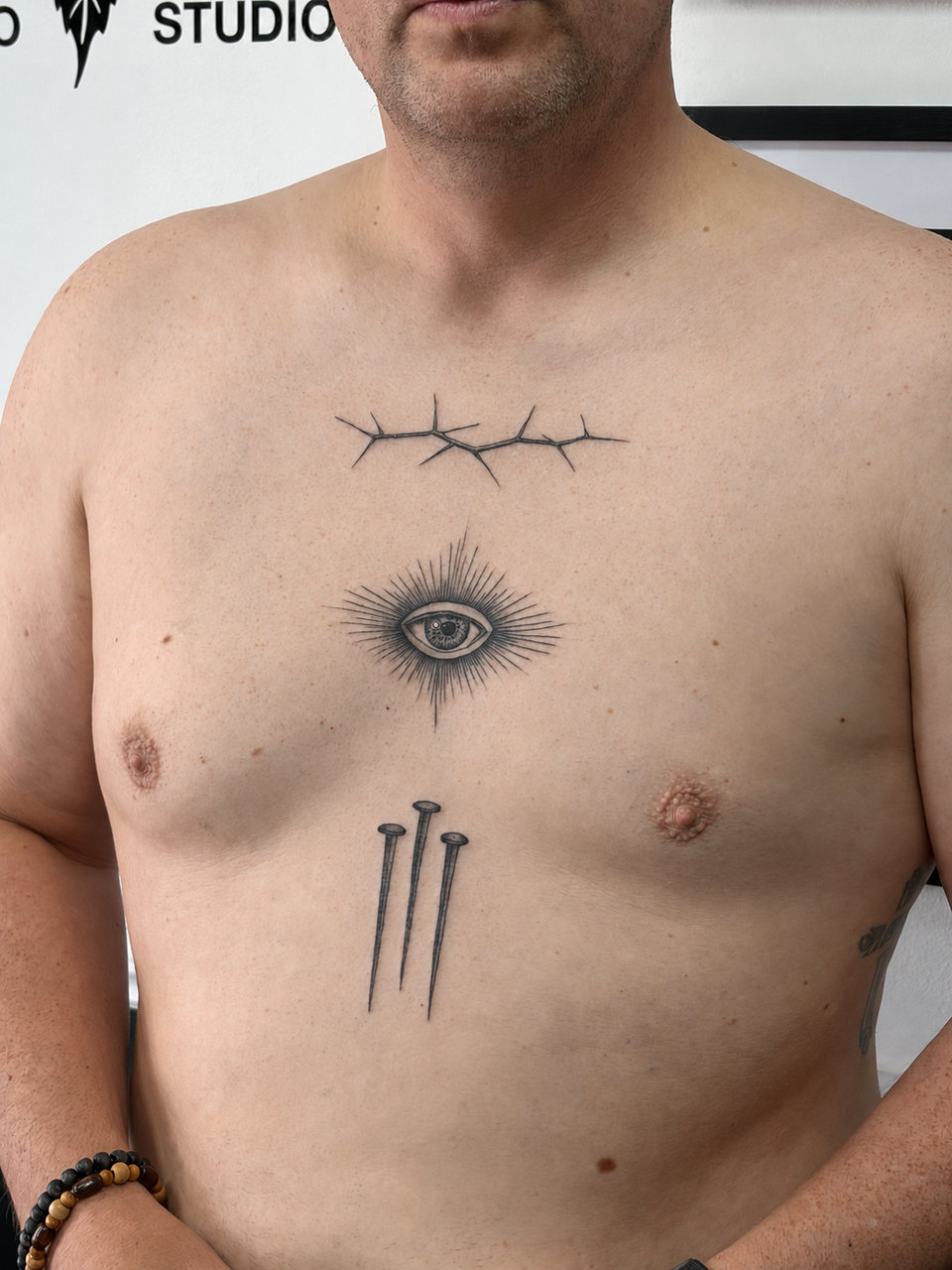 Chest